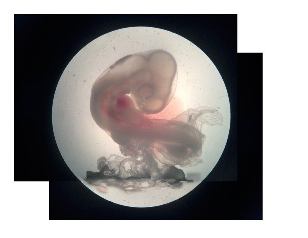 在生物1实验室的解剖显微镜下拍摄的小鸡胚胎受精3周后的照片。